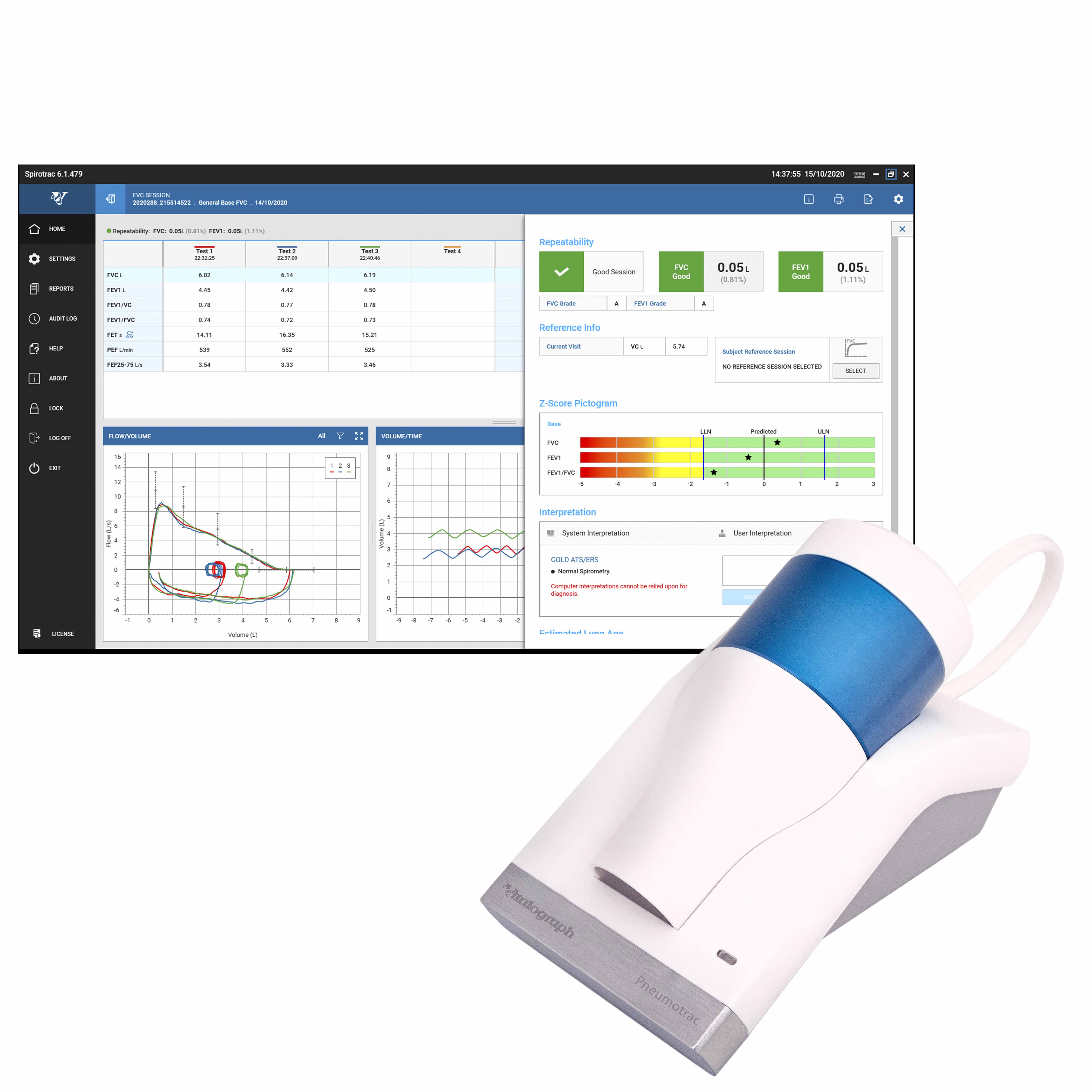 Vitalograph Pneumotrac USB