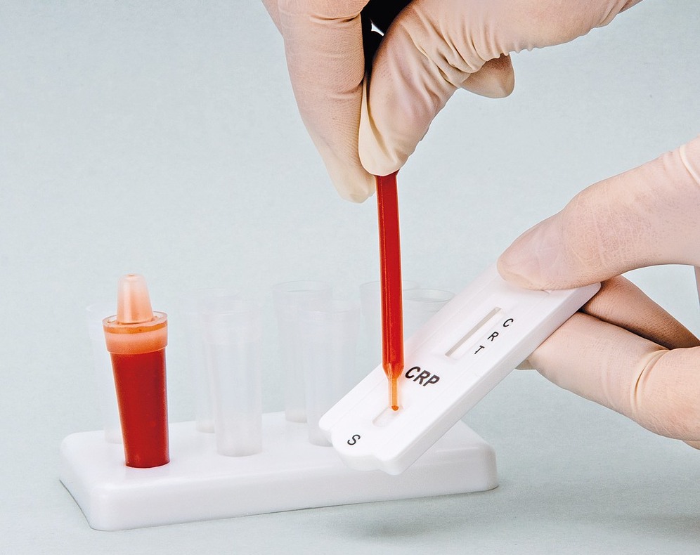 CRP Card Test semiquantitative Bestimmung